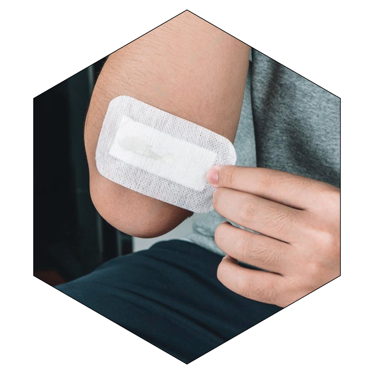 Dermapore Surgical Wound Dressing